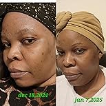 Customer Image, click to open customer review