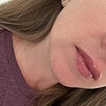 Customer Image, click to open customer review