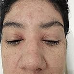 Customer Image, click to open customer review