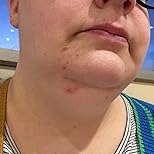 Customer Image, click to open customer review