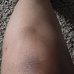 Customer Image, click to open customer review