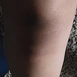 Customer Image, click to open customer review